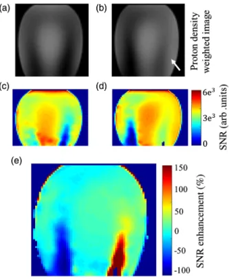 FIG. 6. (a) – (c) Left: Schematic view of the experimental configurations inside the 7 T MRI: birdcage legs in gray circles, specific anthropomorphic mannequin (SAM) in yellow,  position-ing of the BaTiO 3 pad in blue (b) and HMA in red dots (c)
