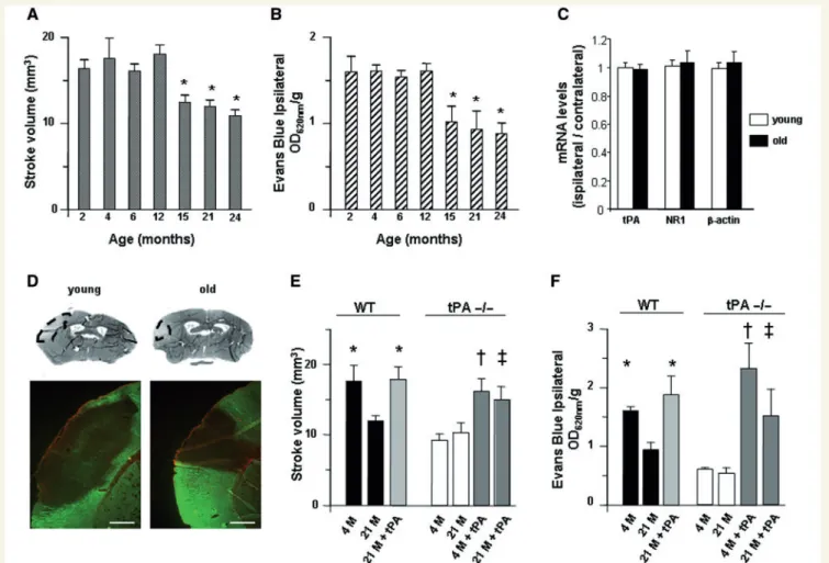 Figure 4 Effect of ageing on ischaemia-induced blood–brain barrier leakage and infarct volumes