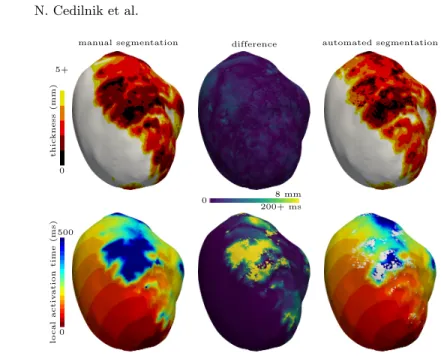 Fig. 4. Impact of the automated segmentation on the thickness and activation maps for one example patient