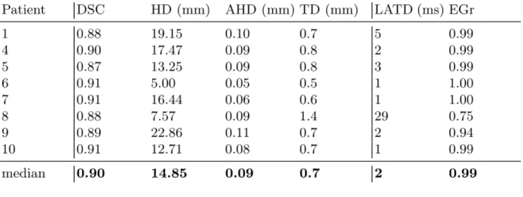 Table 1. [Left] Segmentation quality. DCS: dice score; HD: Hausdorff Distance;