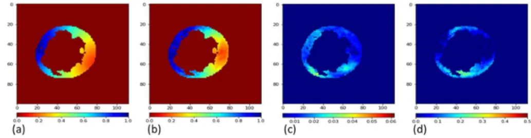 Fig. 6. (a) Simulated and (b) predicted mean activation maps for proposed deep learn- learn-ing based ECGI, (c) Standard deviation map calculated over 10 predictions, (d) error map, difference between predicted and simulated activation maps.