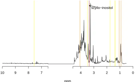Figure 6: “Most important” metabolites locations on the 1 H NMR spectra for the prediction of the total dose of HR ingested by the mouse