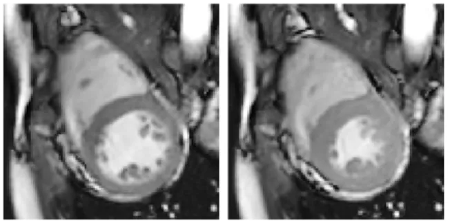 Fig. 5. Registration setting: (left) fixed image, and (right) moving image, at resolution 1.25mm × 1.25mm.