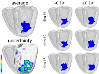 Fig. 3. Infarct location B(ˆ i) predicted from the coordinates ˆ c (top left), its variations along the principal directions around ˆc (right), and corresponding uncertainty U(ˆ i) (bottom left)