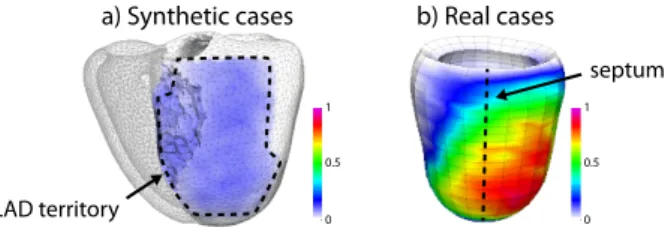 Fig. 7. Average infarct location for the experiments on synthetic and real data.