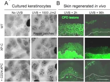 Figure 2. Genetically corrected XP-C keratinocytes exhibit full DNA repair capacity   ex vivo and in vivo in regenerated skin