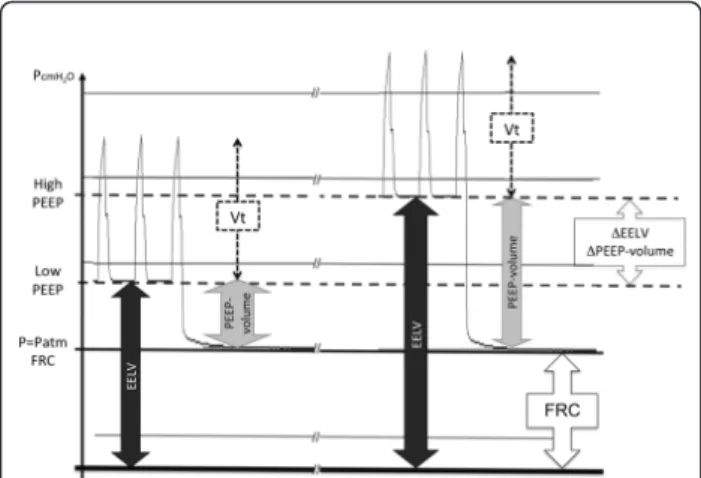 Figure 1 Schematic representation of the pressure-time diagram at the end of each epoch in a single patient
