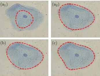 Figure 1: Circle (3 parameters) minimizing color homo- homo-geneity energy (26): (a 1 ) initial estimate; (a 2 ) obtained solution