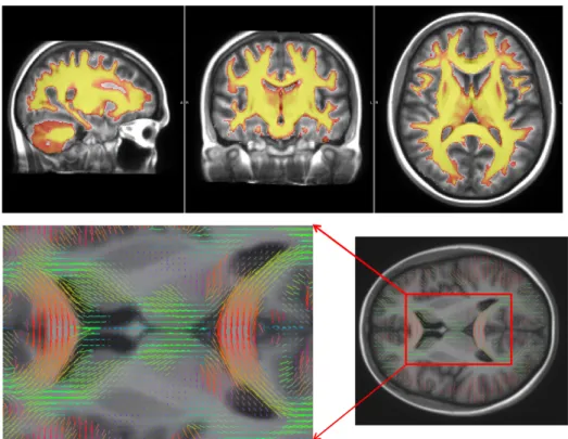 Fig. 3. The multimodal brain template. Top row: FA template overlayed on the T1 template