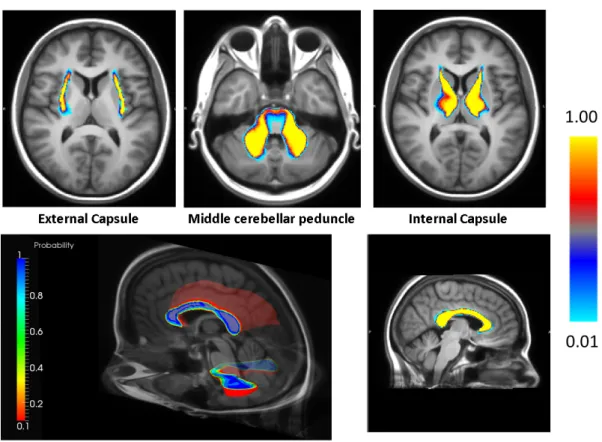 Fig. 4. Probabilistic ROIs for some of the representative white matter structures are shown overlayed on the T1 image for anatomical reference