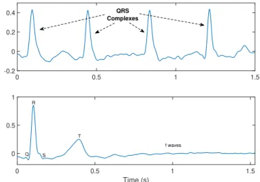 Fig. 2: Top: a 1.5-second segment of an AF ECG recording (in mV) with 4 QRS complexes from one patient (P2)