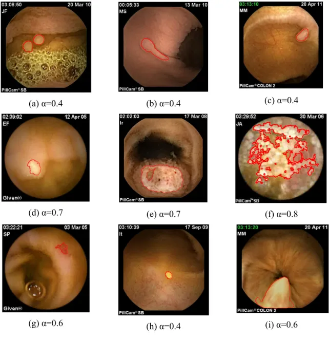 Fig.  9:  WCE  image  segmentation  using  the  proposed  histogram-based  active  contour  approach