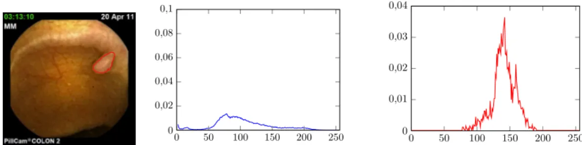 Fig.  6  Illustration  of  the  non-Gaussianity  of  the  PDF  (luminance)  extracted  from  a  WCE  image  presenting with a polyp