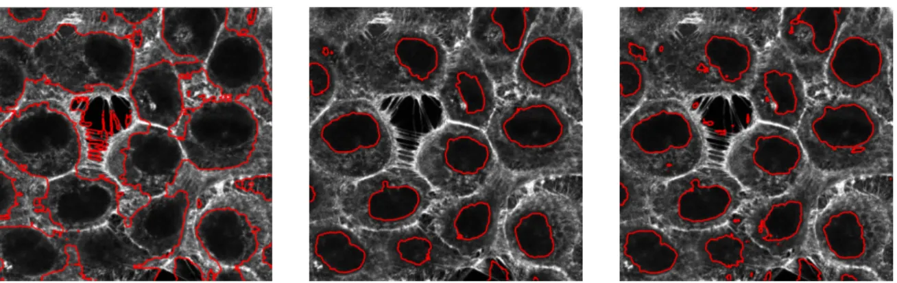 Figure 9: Comparative results of nuclei segmentation. Left: Shannon’s entropy ; Middle and Right: Fractional entropy descriptor with α = 0.5 (middle) and α = 0.7 (right) ; for all experiments g = 10.