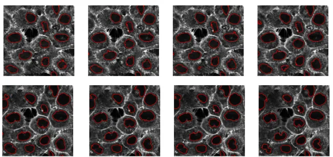 Figure 11: Segmentation of nuclei made on upper (upper row) and lower (bottom row) slices of the stack, mid-slice of Fig