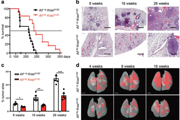 Fig. 1 Reduced lung cancer in Aif-de ﬁ cient Kras G12D mice. a Aif deletion signi ﬁ cantly prolongs the survival of mice infected with Ad5-CMV-Cre in comparison to their Aif WT controls