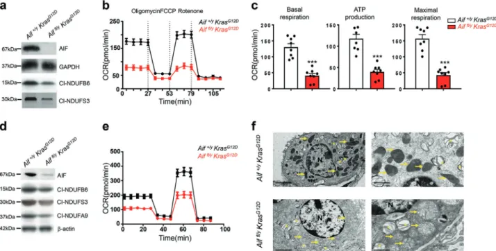 Fig. 2 Loss of AIF compromises OXPHOS and impairs mitochondrial structure in lung tumor cells