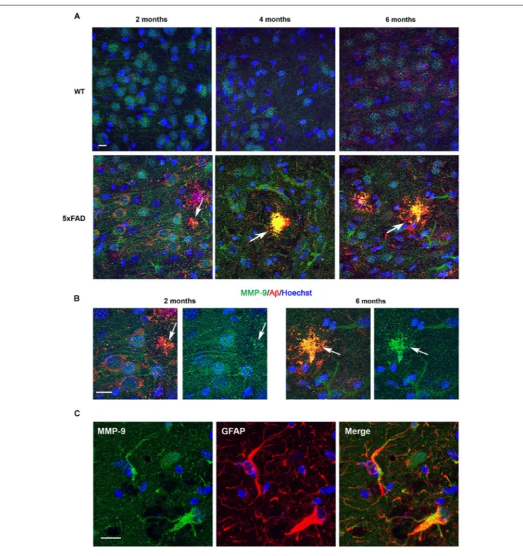 FIGURE 4 | Age-dependent upregulation of MMP-9 expression in astrocytes and amyloid plaques in 5xFAD mice hippocampi