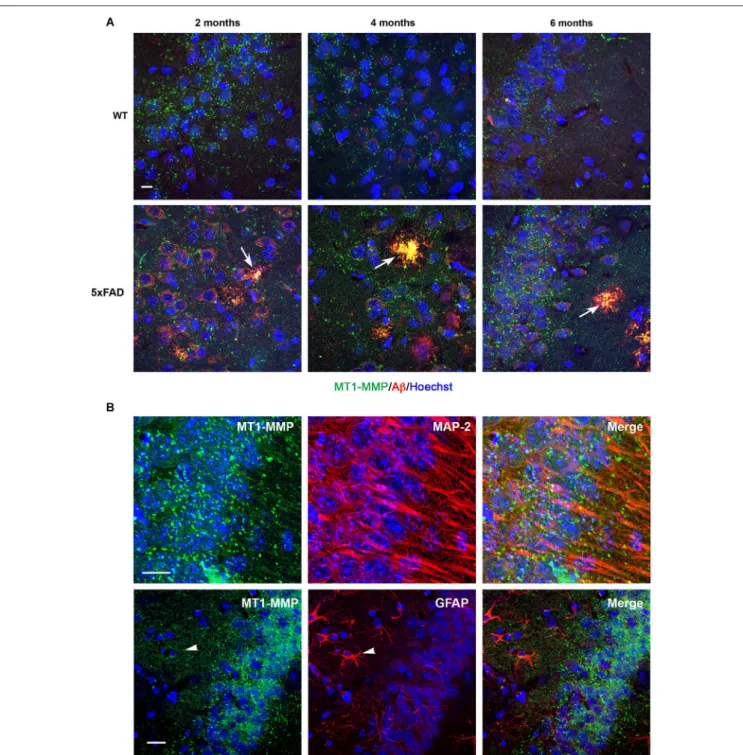 FIGURE 5 | Age-dependent upregulation of MT1-MMP expression in neurons and amyloid plaques in 5xFAD mice hippocampi