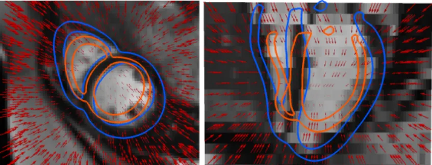 Fig. 1: Example of a reference deformation SVF (red vector field scaled at 0.3) computed from two segmented surfaces
