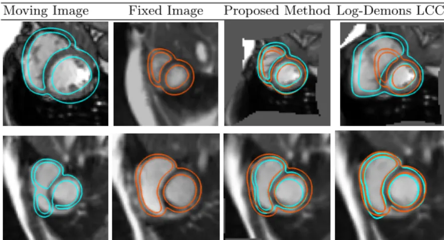 Fig. 4: Two examples of the results of our registration method versus optimiza- optimiza-tion approach