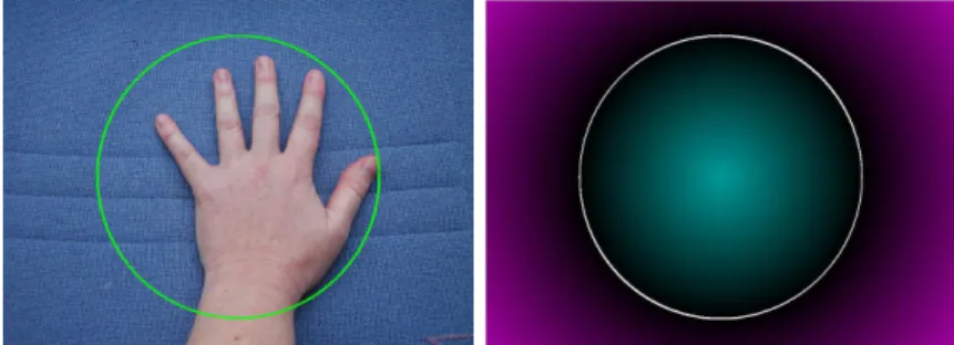 Fig. 4. On the left: original image with the isolevel 0 (initialization). On the right: distance map corresponding.