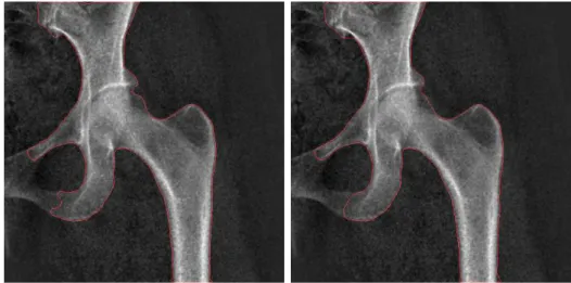 Fig. 2. Segmentation of “X-ray”: Segmentation using a smoothing spline with 256 sampling points and λ equal to: 0.005 (left) and 0.025 (right).