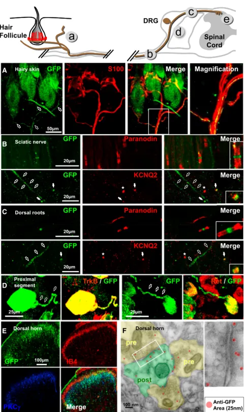 Figure 4. Subcellular Localization of Cav3.2 in Primary Sensory Neurons