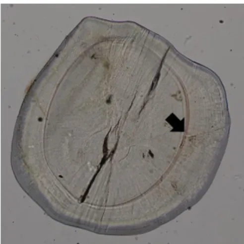 Figure  2 :  Photo  d’un  otolithe  d’un  gobie  du  genre  Sicyopterus  de  43 mm  de  longueur  totale  capturé  en  eau  douce