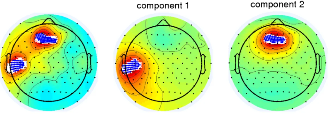 Figure 8: Topographic plots of the electric potential distribution on the surface of the scalp showing the localization results for 2 distributed sources for EEG data recorded with 128 sensors for 100 time samples and a SNR of -3 dB