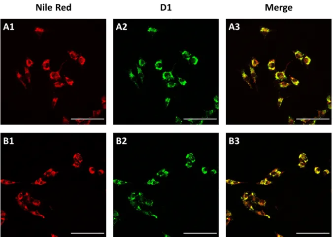Figure 10. Confocal microscopy of melanoma cells (2 fields) exposed to oleic acid for 24 h and co-stained with probe D1 (100 nM)  and Nile Red (300 nM), as the reference marker for LDs