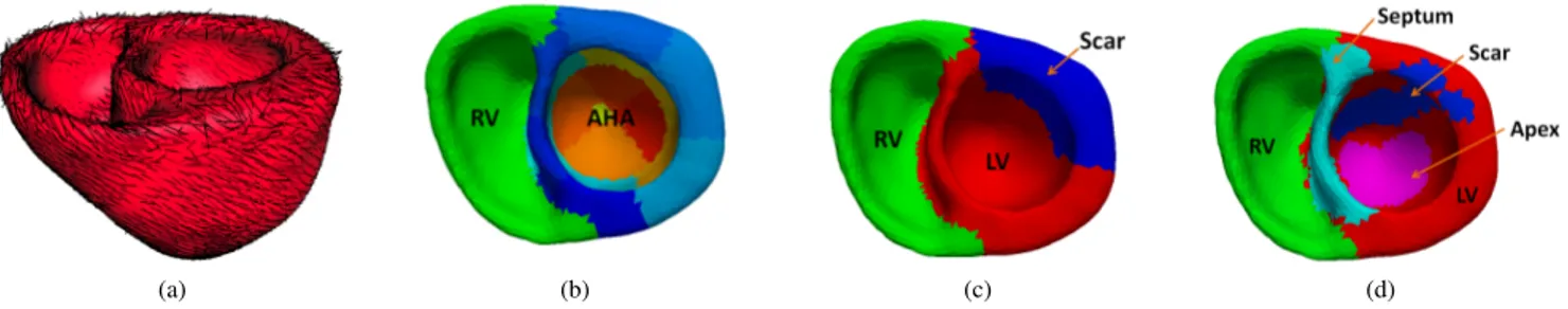 Figure 1: Heart representation. (a) Heart geometry and fiber orientations. (b) AHA-zone representation
