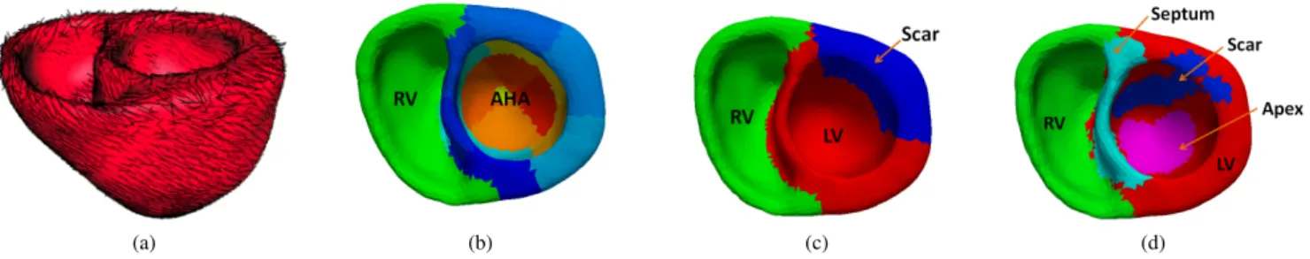 Figure 1: Heart representation. (a) Heart geometry and fiber orientations. (b) AHA-zone representation