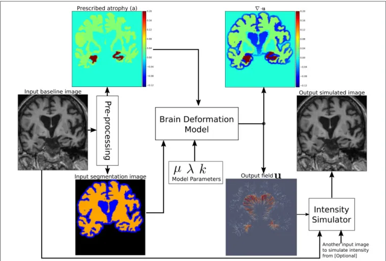 Figure 1 shows a diagram of the complete framework. To implement this framework, we have developed an open-source atrophy simulator software called Simul@trophy 1 