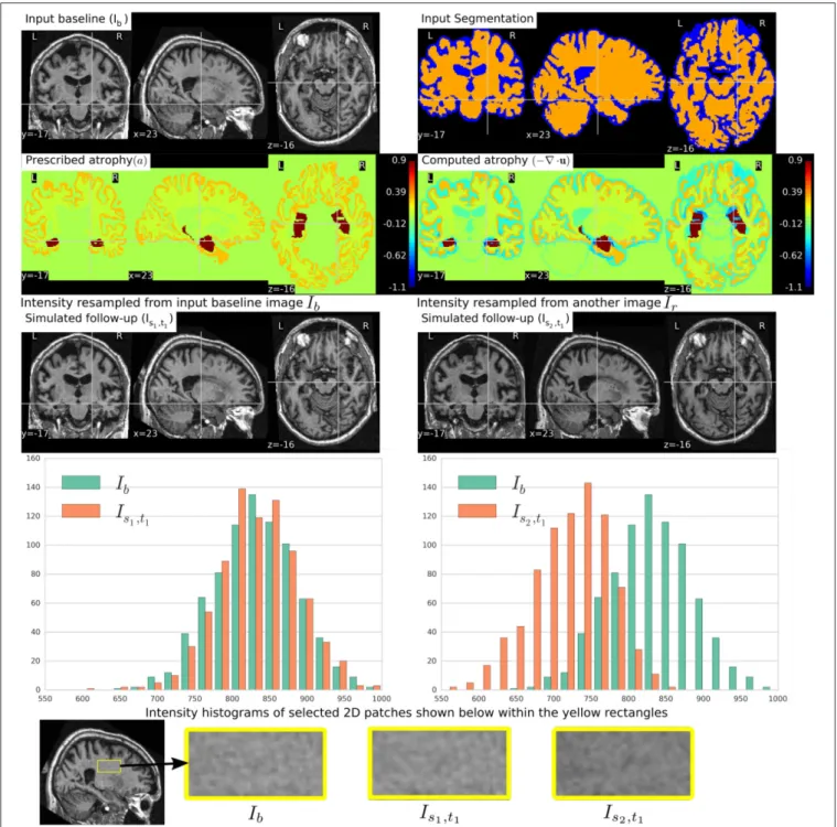 FIGURE 5 | Two simulated images are shown on the third row where the image on the left is resampled from the input baseline image I b , and the image on the right is resampled from another image I r of the same subject