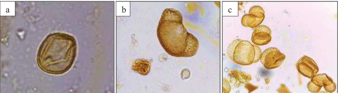 Figure 20: Exemples des pollens identifiés ; a) Quercus rotundifolia ; b) Cedrus atlanticaPinus; c) Pinus