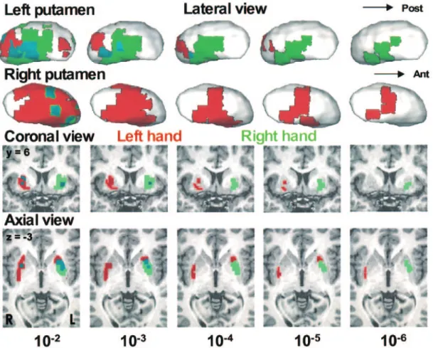 Figure 4. Variation of the overlap (light blue) between the left (red) and the right (light green) hand areas in the putamen as a function of the level of statistical stringency (from P <