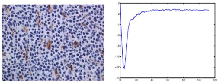 Fig. 2. An ectopic model image at the 15 th day (left) and its corresponding L-function (right): The negative peak shows strong evidence of regularity at this scale.