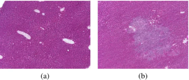 Fig. 1. Images showing the variations in texture between sane tissue and metastases. (a) without metastases despite being of grade 1 while (b) with metastases and of grade 3.