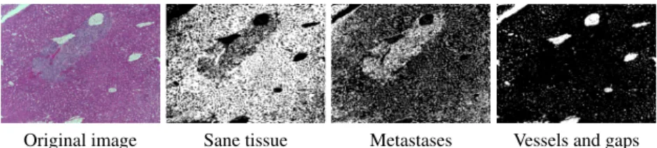 Fig. 4. Three patches extracted on a representative image and their decomposition into biological objects