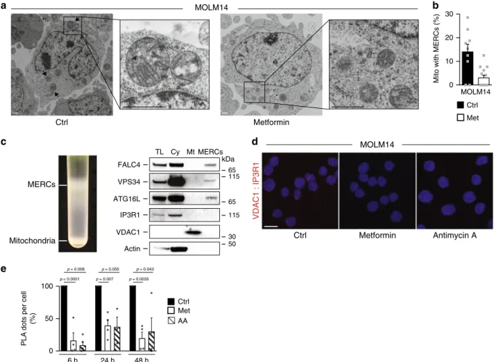 Fig. 4 OxPHOS regulates MERCs number and function. a MOLM14 cells treated with metformin (Met, 10 mM) for 24 h were ﬁ xed and processed for electron microscopy analysis