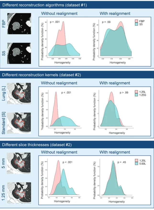 Figure 3:   Probability density function of homogeneity before (without realignment) and after (with realignment) ComBat in  patient data by using two CT reconstruction algorithms, two reconstruction kernels, and two voxel thicknesses