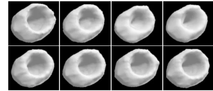 Figure 3: MCAT: Some transverse slices of the 3-D space-time segmentation of the 8th frame.