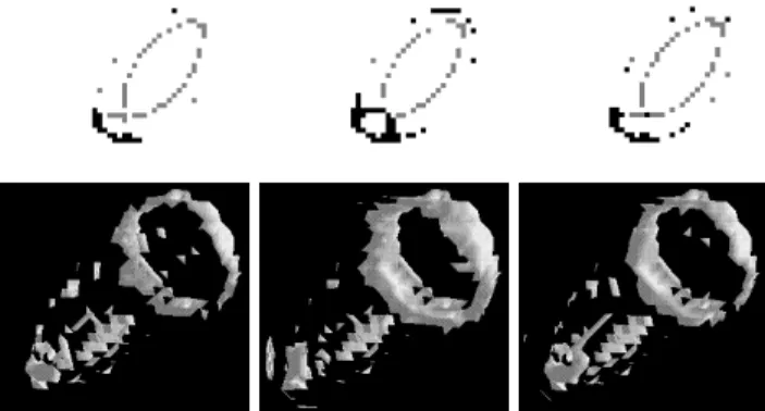 Figure 11: MCAT segmentation errors in the third frame (end systole). First and second row: Same  con-figuration as in figure 10.