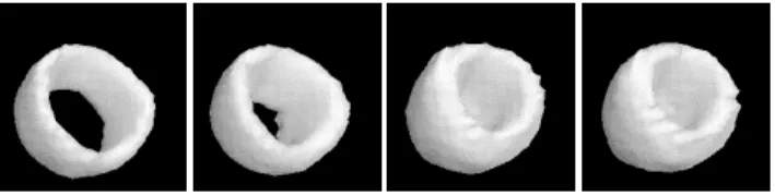 Figure 14: MCAT: 3-D space-time segmentation ob- ob-tained when δ equals 2000, first four frames.