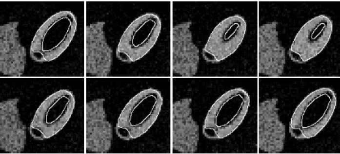 Figure 1: MCAT: 3-D space-time segmentation of the left ventricle. Chronological order from left to right and top to bottom.