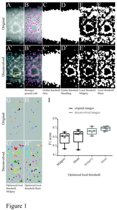 Figure 1. Performance of global and local thresholding methods in the detection of heat-induced granules on  original and deconvolved epifluorescence images of C