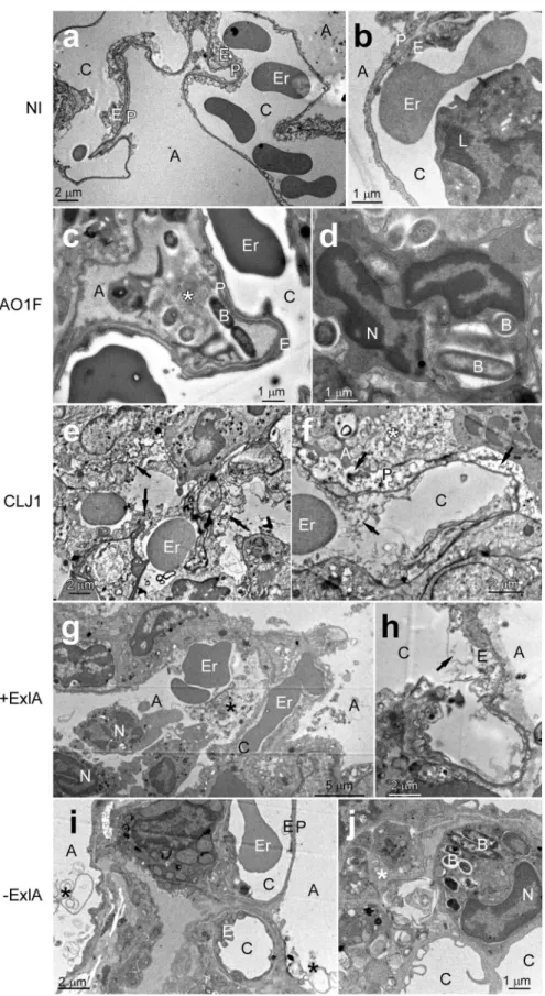 Figure 2.  Electron micrographs of infected lungs. (a–j) Mice (n  = 2 per strain) were infected with 5 × 10 6 bacteria from PAO1F, CLJ1, PAO1FΔT3SS::exlBA (+ExlA) or PAO1FΔT3SS::empty vector (−ExlA) strains,  or were uninfected (NI), as indicated (2 images