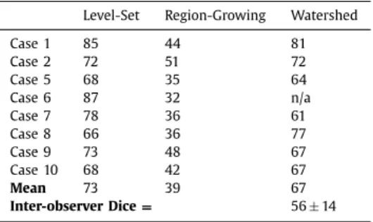 Fig.  11. The ranking methodology  illustrates  how each  algorithm  was  ﬁnally  ranked  in CT, based on  its rank (  R  )  within  each  metric: Dice  (  D  ), thickness (  dT  )  and  volume  (  dV  )