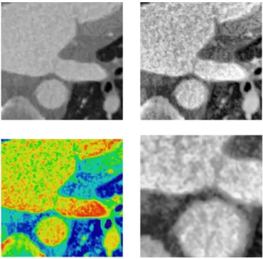 Fig. 4. Contrast limited adaptive histogram equalisation (CLAHE) ﬁlter applied to  each  slice  along with bilinear greyscale  mapping  for  enhancing contrast in the wall